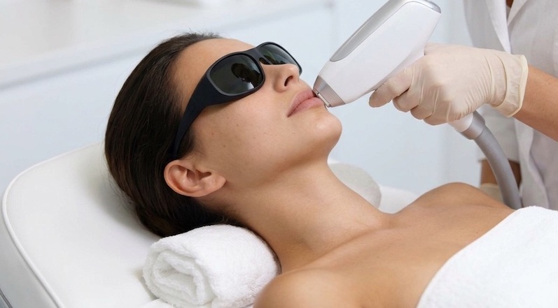 Depilación LÁSER en San Sebastián de los reyes. Facial, corporal y zonas delicadas